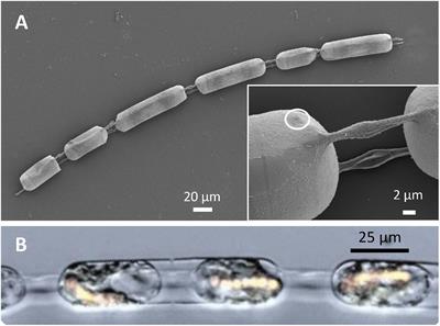 Adaptation to an Intracellular Lifestyle by a Nitrogen-Fixing, Heterocyst-Forming Cyanobacterial Endosymbiont of a Diatom